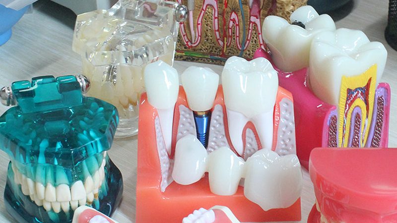全口种植牙国产和进口哪个适合老年人